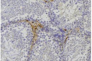 ABIN6276747 at 1/100 staining Mouse testis tissue by IHC-P. (alpha Adducin anticorps  (C-Term))