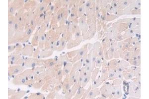 Detection of THBS1 in Mouse Heart Tissue using Polyclonal Antibody to Thrombospondin 1 (THBS1)