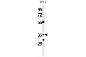 Western blot analysis of NSE4A Antibody (N-term) in WiDr cell line lysates (35µg/lane). (NSMCE4A anticorps  (N-Term))
