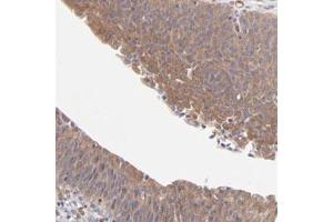 Immunohistochemical staining (Formalin-fixed paraffin-embedded sections) of human urinary bladder with ASB7 polyclonal antibody  shows moderate cytoplasmic positivity in urothelial cells. (ASB7 anticorps)