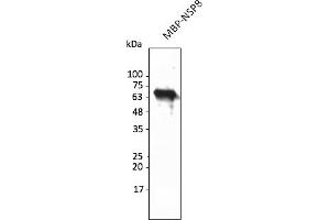 Western Blotting (WB) image for anti-SARS-CoV-2 Non-Structural Protein 8 (NSP8) antibody (ABIN7273001) (SARS-CoV-2 NSP8 anticorps)