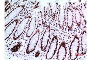 Immunohistochemistry (IHC) analysis of paraffin-embedded Human Colon, antibody was diluted at 1:100.