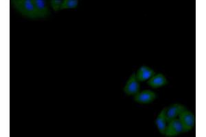 Detection of CK18 in Human MCF7 cell using Polyclonal Antibody to Cytokeratin 18 (CK18)