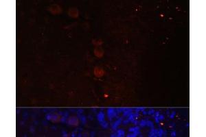 Immunofluorescence analysis of Rat brain using NEFM Polyclonal Antibody at dilution of 1:100. (NEFM anticorps)