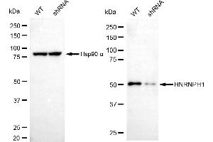 Western blotting analysis using HNRNPH1 antibody (ABIN7798898).
