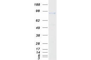 Validation with Western Blot