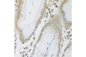 Immunohistochemistry of paraffin-embedded human stomach using ENPEP antibody at dilution of 1:200 (40x lens). (ENPEP anticorps)