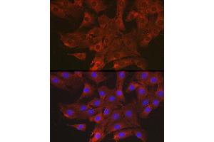 Immunofluorescence analysis of NIH-3T3 cells using CCL3 Rabbit pAb (ABIN6130184, ABIN6138061, ABIN6138062 and ABIN6223474) at dilution of 1:100 (40x lens). (CCL3 anticorps  (AA 24-92))