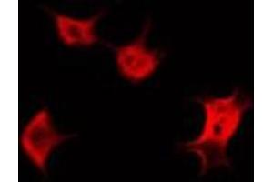 ABIN6266573 staining HeLa by IF/ICC.