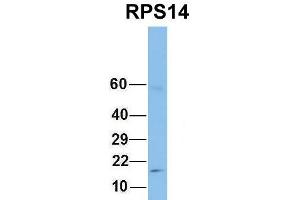 Host:  Rabbit  Target Name:  RPS14  Sample Type:  Human Fetal Lung  Antibody Dilution:  1.