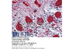 Immunohistochemistry (IHC) image for anti-Vascular Endothelial Zinc Finger 1 (VEZF1) (Middle Region) antibody (ABIN2776482)