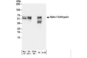 Western Blotting (WB) image for anti-serpin Peptidase Inhibitor, Clade A (Alpha-1 Antiproteinase, Antitrypsin), Member 1 (SERPINA1) antibody (ABIN7449476)
