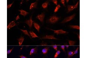 Immunofluorescence analysis of C6 cells using DNASE1L1 Polyclonal Antibody at dilution of 1:100. (DNASEX anticorps)