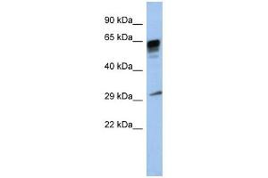 PRR18 antibody used at 1 ug/ml to detect target protein. (Proline Rich 18 anticorps  (Middle Region))