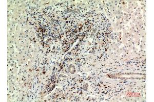 Immunohistochemistry (IHC) analysis of paraffin-embedded Human Liver, antibody was diluted at 1:100. (CD74 anticorps  (Internal Region))