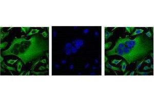 Western Blotting (WB) image for anti-Tubulin, beta (TUBB) antibody (ABIN3178583) (TUBB anticorps)