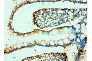 Immunohistochemistry of paraffin-embedded human small intestine tissue using ABIN7164791 at dilution of 1:100 (FAP anticorps  (AA 26-280))