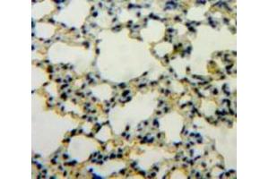 Used in DAB staining on fromalin fixed paraffin-embedded Lung tissue (IL1A anticorps  (AA 116-270))