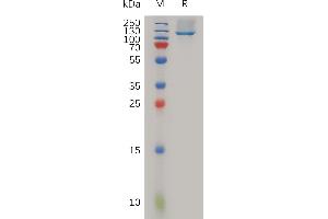 Human Protein, His Tag on SDS-PAGE under reducing condition.