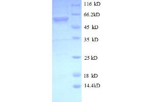 SDS-PAGE (SDS) image for Mitogen-Activated Protein Kinase Kinase 4 (MAP2K4) (AA 2-397) protein (His-SUMO Tag) (ABIN5709899)