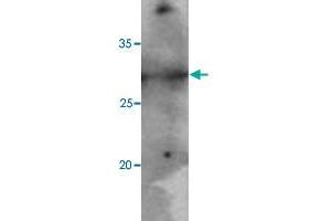Jurkat cell lysates (40 ug) were resolved by SDS-PAGE, transferred to PVDF membrane and probed with PNMT monoclonal antibody, clone AT1C11  (1:500). (PNMT anticorps  (AA 1-282))