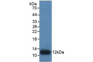 Detection of Recombinant IL8, Human using Monoclonal Antibody to Interleukin 8 (IL8) (IL-8 anticorps  (AA 28-99))