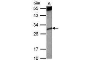 Image no. 2 for anti-Killer Cell Immunoglobulin-Like Receptor, Two Domains, Short Cytoplasmic Tail, 4 (KIR2DS4) (AA 1-294) antibody (ABIN1499052) (KIR2DS4 anticorps  (AA 1-294))