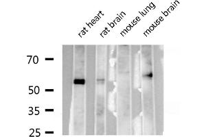 Western blot analysis of RUNX2 expression in various lysates (RUNX2 anticorps  (Internal Region))