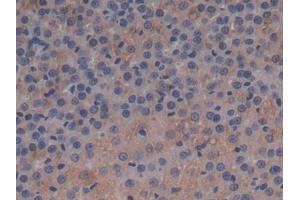 DAB staining on IHC-P; Samples: Rat Adrenal gland Tissue