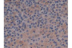 DAB staining on IHC-P; Samples: Rat Adrenal gland Tissue (APOC1 anticorps  (AA 34-88))