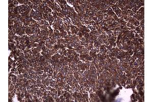 Immunohistochemistry (IHC) image for anti-Keratin Acidic (AE1) antibody (ABIN2715666)