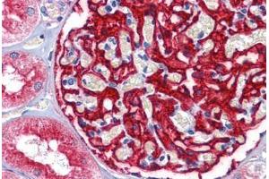 Human Kidney: Formalin-Fixed, Paraffin-Embedded (FFPE) (ENPEP anticorps  (AA 689-932))