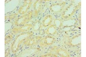 Immunohistochemistry of paraffin-embedded human kidney tissue using ABIN7148336 at dilution of 1:100 (C1QB anticorps  (AA 104-253))