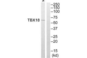 Western blot analysis of extracts from Jurkat cells, using TBX18 antibody. (T-Box 18 anticorps  (Internal Region))