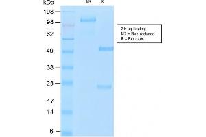 SDS-PAGE Analysis of Purified MUC16 Rabbit Recombinant Monoclonal Antibody (OCA125/2349R). (Recombinant MUC16 anticorps)