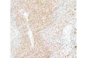 Immunohistochemistry (IHC) image for anti-Lectin, Galactoside-Binding, Soluble, 9 (LGALS9) (AA 305-355) antibody (ABIN7449427)