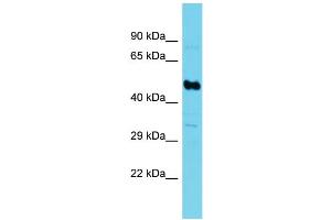 Western Blotting (WB) image for anti-Succinate-CoA Ligase, GDP-Forming, beta Subunit (SUCLG2) (N-Term) antibody (ABIN2790591) (SUCLG2 anticorps  (N-Term))