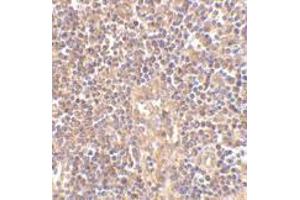 Immunohistochemistry of ATM in human lymph node tissue with this product atM antibody at 2. (ATM anticorps  (C-Term))