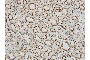 Immunoperoxidase of monoclonal antibody to RPRD1A on formalin-fixed paraffin-embedded human kidney.