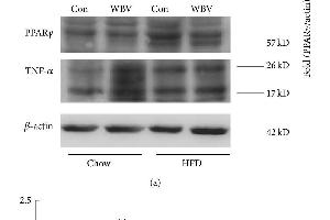 Protein expression of PPARγ, IL-6, and TNF-α in WAT after vibration for 8 weeks.