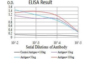 Black line: Control Antigen (100 ng),Purple line: Antigen (10 ng), Blue line: Antigen (50 ng), Red line:Antigen (100 ng)