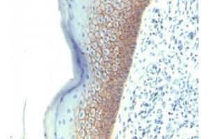 Formalin-fixed, paraffin-embedded human skin stained with E-Cadherin antibody (CDH1/1525). (E-cadherin anticorps)