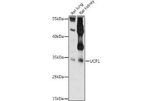 Western blot analysis of extracts of various cell lines, using UCP1 antibody  at 1:1000 dilution. (UCP1 anticorps)
