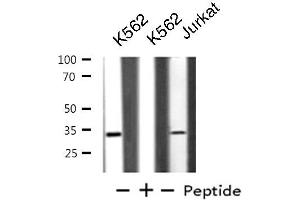 Western blot analysis of extracts from K562/Jurkat cells, using BTLA antibody. (BTLA anticorps  (C-Term))