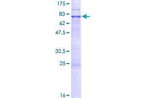 Image no. 1 for Epithelial Stromal Interaction 1 (Breast) (EPSTI1) (AA 1-410) protein (GST tag) (ABIN1352992)