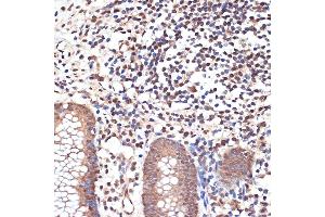 Immunohistochemistry of paraffin-embedded human appendix using K/MYST1/MOF Rabbit mAb (ABIN7268063) at dilution of 1:100 (40x lens). (MYST1 anticorps)