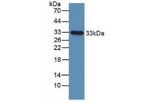 Detection of IGFBP2 in Human Urine using Polyclonal Antibody to Insulin Like Growth Factor Binding Protein 2 (IGFBP2)