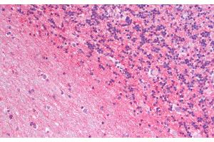 Immunohistochemistry analysis of paraffin-embedded Human Cerebellum using GAP43 Polyclonal Antibody. (GAP43 anticorps)
