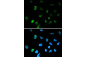 Immunofluorescence analysis of HepG2 cell using CGA antibody.