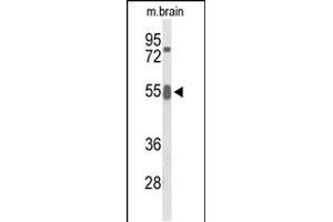 Western blot analysis of GRB7 Antibody (Center) (ABIN653423 and ABIN2842868) in mouse brain tissue lysates (35 μg/lane). (GRB7 anticorps  (AA 289-318))